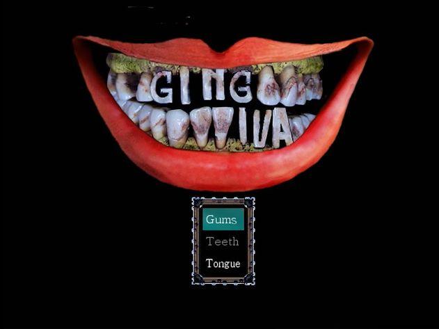 Gingiva